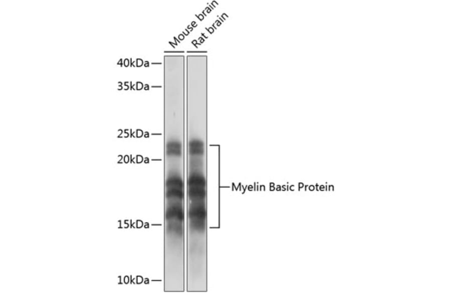 Western Blot - Anti-Myelin Basic Protein Antibody [ARC0535] (A80785) - Antibodies.com