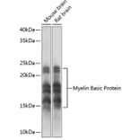 Western Blot - Anti-Myelin Basic Protein Antibody [ARC0535] (A80785) - Antibodies.com