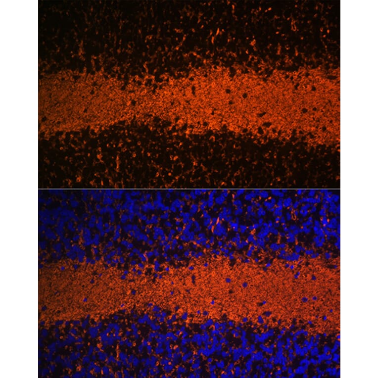 Immunofluorescence - Anti-Myelin Basic Protein Antibody [ARC0535] (A80785) - Antibodies.com