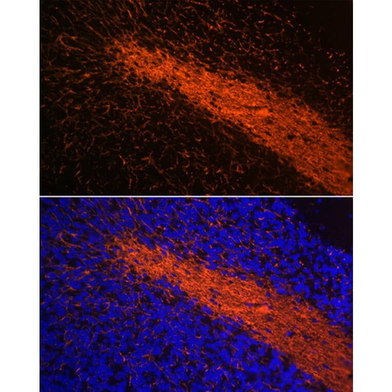 Immunofluorescence - Anti-Myelin Basic Protein Antibody [ARC0535] (A80785) - Antibodies.com