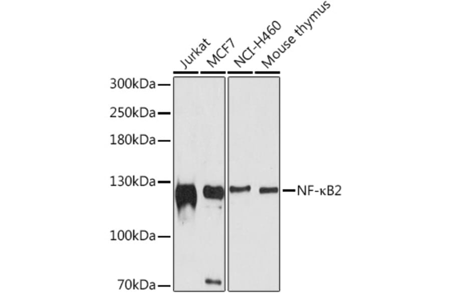 Western Blot - Anti-NFkB p100/NFKB2 Antibody (A80786) - Antibodies.com