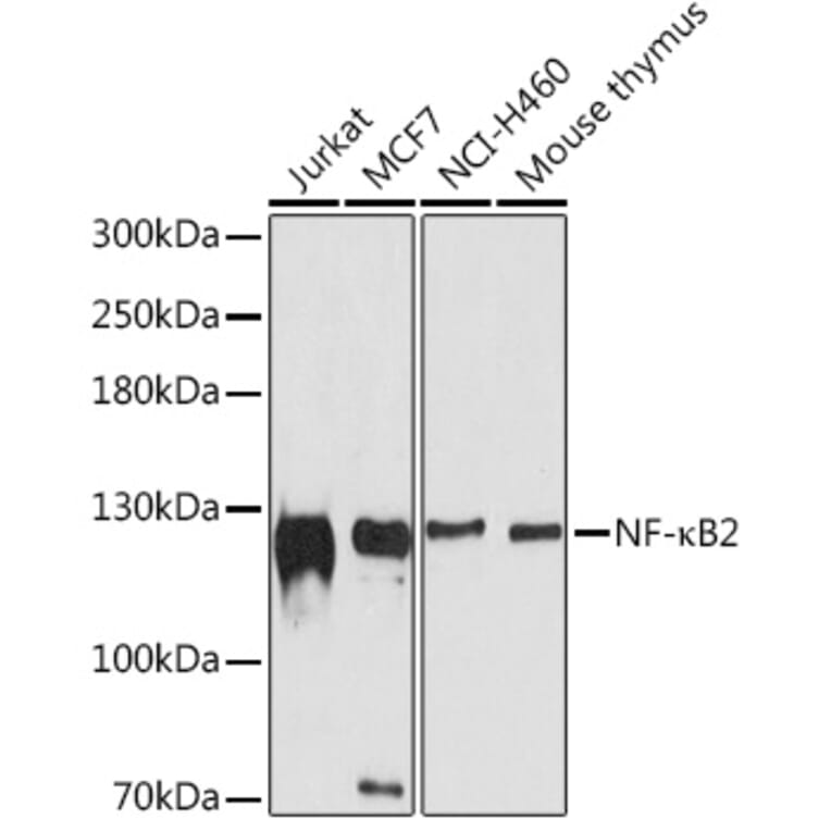 Western Blot - Anti-NFkB p100/NFKB2 Antibody (A80786) - Antibodies.com