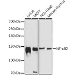 Western Blot - Anti-NFkB p100/NFKB2 Antibody (A80786) - Antibodies.com
