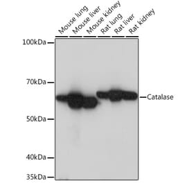 Western Blot - Anti-Catalase Antibody [ARC0550] (A80787) - Antibodies.com