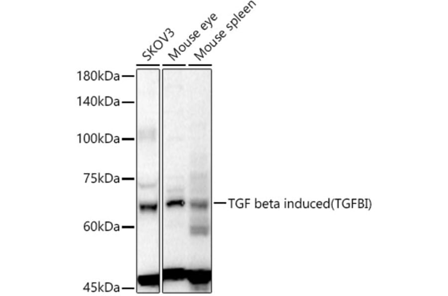 Western Blot - Anti-TGFBI Antibody (A80788) - Antibodies.com