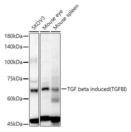 Western Blot - Anti-TGFBI Antibody (A80788) - Antibodies.com
