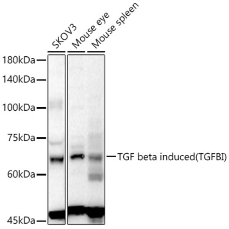Western Blot - Anti-TGFBI Antibody (A80788) - Antibodies.com