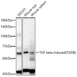 Western Blot - Anti-TGFBI Antibody (A80788) - Antibodies.com