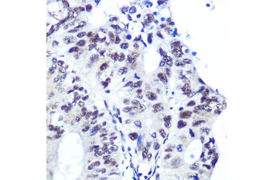 Immunohistochemistry - Anti-Ku70 Antibody [ARC0551] (A80789) - Antibodies.com