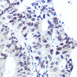 Immunohistochemistry - Anti-Ku70 Antibody [ARC0551] (A80789) - Antibodies.com