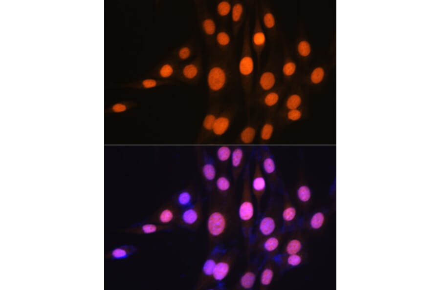 Immunofluorescence - Anti-Ku70 Antibody [ARC0551] (A80789) - Antibodies.com