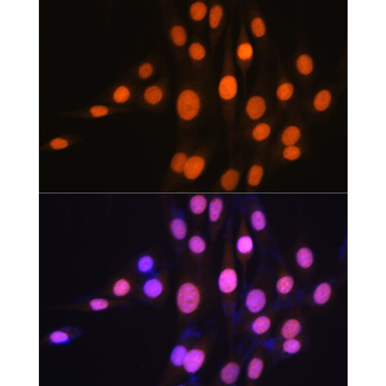 Immunofluorescence - Anti-Ku70 Antibody [ARC0551] (A80789) - Antibodies.com