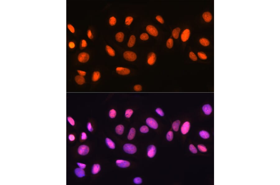 Immunofluorescence - Anti-Ku70 Antibody [ARC0551] (A80789) - Antibodies.com