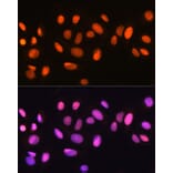 Immunofluorescence - Anti-Ku70 Antibody [ARC0551] (A80789) - Antibodies.com