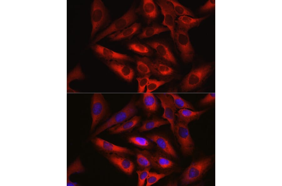 Immunofluorescence - Anti-Keap1 Antibody (A80790) - Antibodies.com