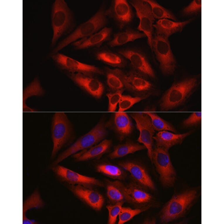 Immunofluorescence - Anti-Keap1 Antibody (A80790) - Antibodies.com