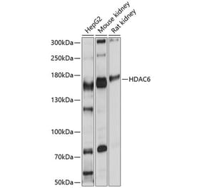 Western Blot - Anti-HDAC6 Antibody (A80791) - Antibodies.com