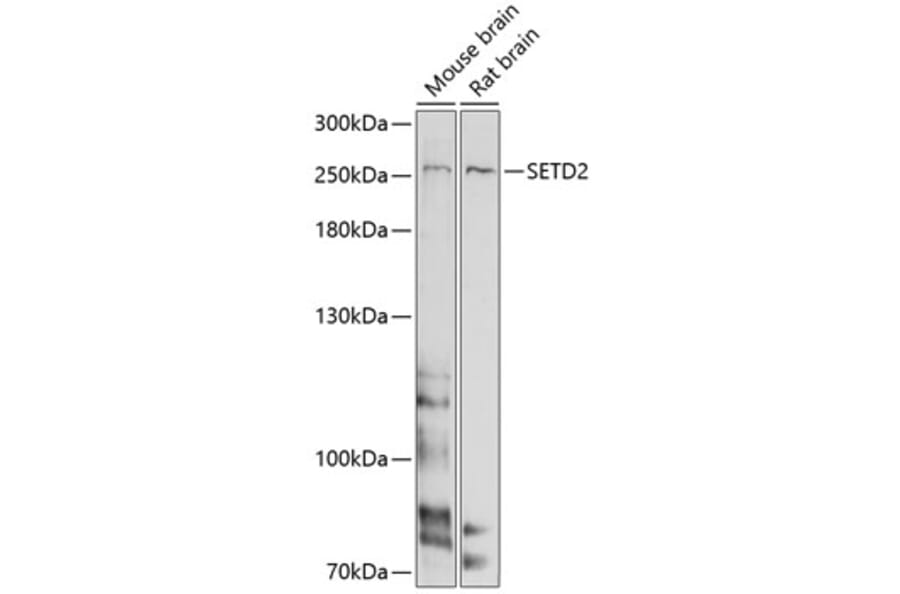 Western Blot - Anti-SETD2 Antibody (A11271) - Antibodies.com