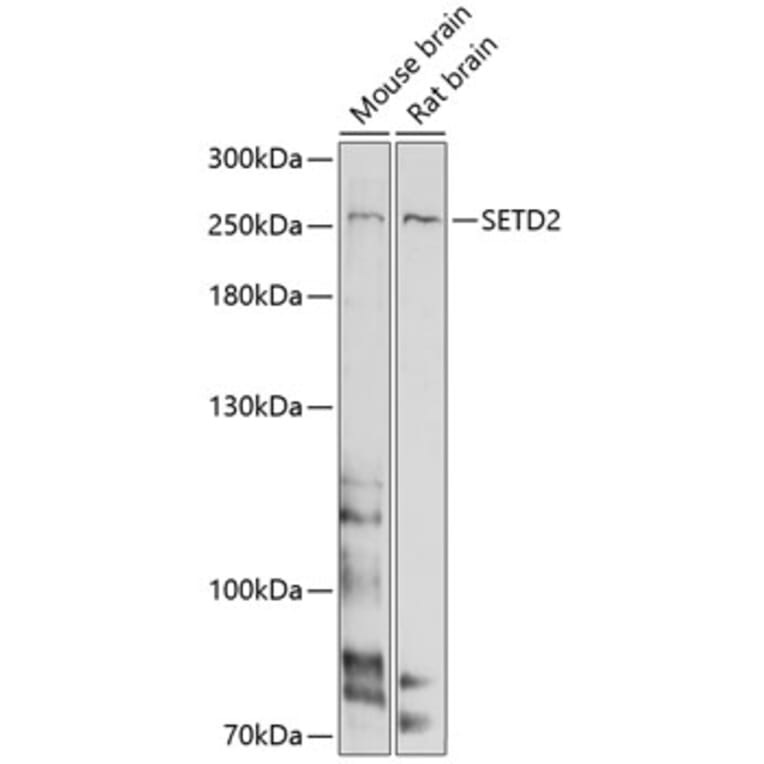 Western Blot - Anti-SETD2 Antibody (A11271) - Antibodies.com