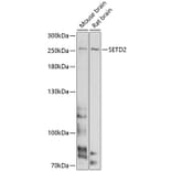 Western Blot - Anti-SETD2 Antibody (A11271) - Antibodies.com