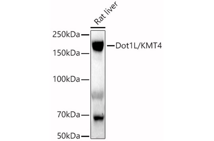 Western Blot - Anti-KMT4/Dot1L Antibody (A80793) - Antibodies.com
