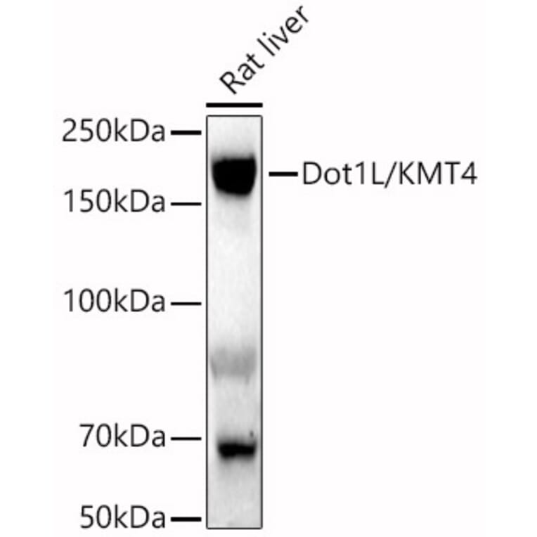 Western Blot - Anti-KMT4/Dot1L Antibody (A80793) - Antibodies.com