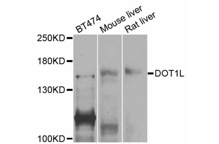Western Blot - Anti-DOT1L Antibody (A11286) - Antibodies.com