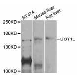 Western Blot - Anti-DOT1L Antibody (A11286) - Antibodies.com