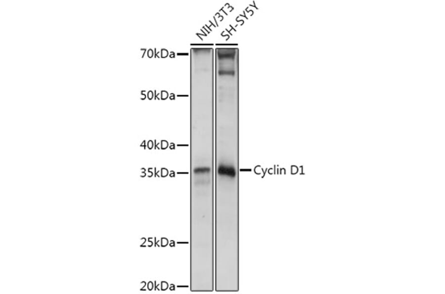 Western Blot - Anti-Cyclin D1 Antibody (A80795) - Antibodies.com