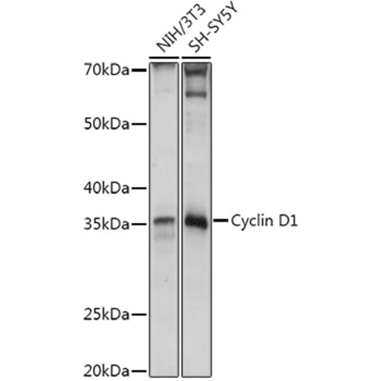 Western Blot - Anti-Cyclin D1 Antibody (A80795) - Antibodies.com