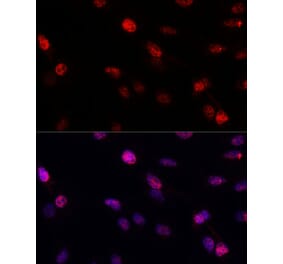 Immunofluorescence - Anti-BRCA1 Antibody (A80796) - Antibodies.com