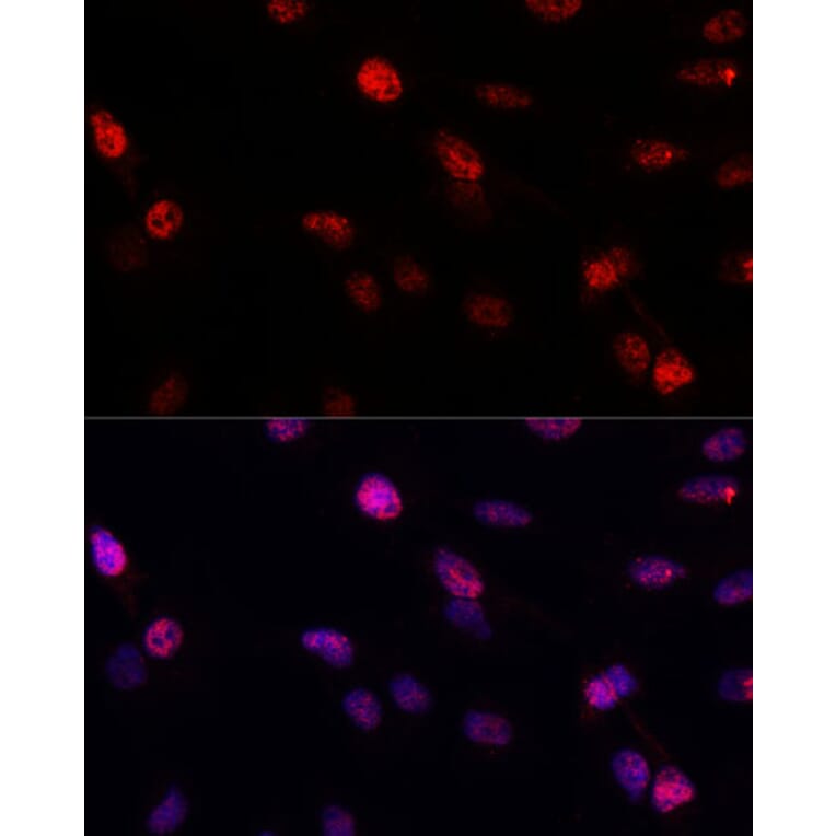 Immunofluorescence - Anti-BRCA1 Antibody (A80796) - Antibodies.com