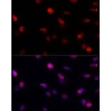 Immunofluorescence - Anti-BRCA1 Antibody (A80796) - Antibodies.com