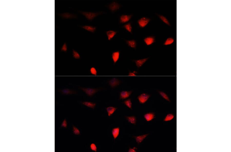 Immunofluorescence - Anti-BRCA1 Antibody (A80796) - Antibodies.com