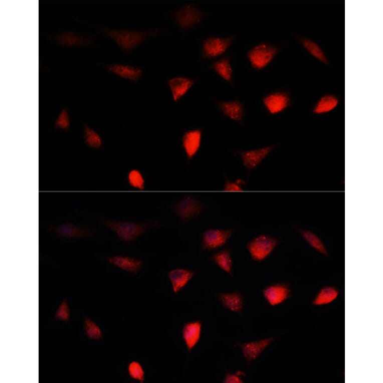 Immunofluorescence - Anti-BRCA1 Antibody (A80796) - Antibodies.com