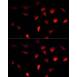 Immunofluorescence - Anti-BRCA1 Antibody (A80796) - Antibodies.com