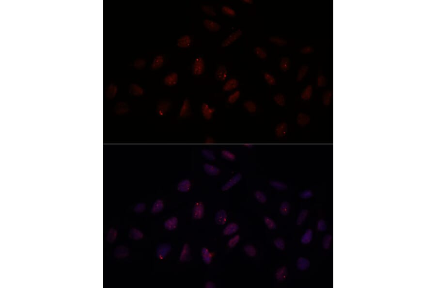 Immunofluorescence - Anti-BRCA1 Antibody (A80796) - Antibodies.com