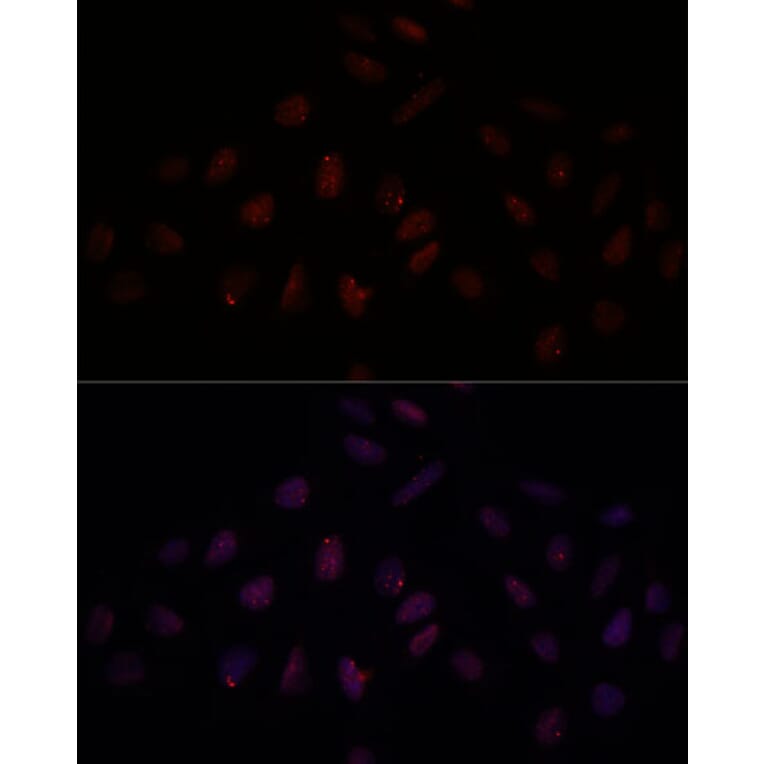 Immunofluorescence - Anti-BRCA1 Antibody (A80796) - Antibodies.com