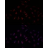 Immunofluorescence - Anti-BRCA1 Antibody (A80796) - Antibodies.com