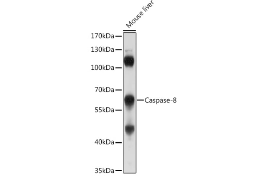 Western Blot - Anti-Caspase-8 Antibody (A80797) - Antibodies.com