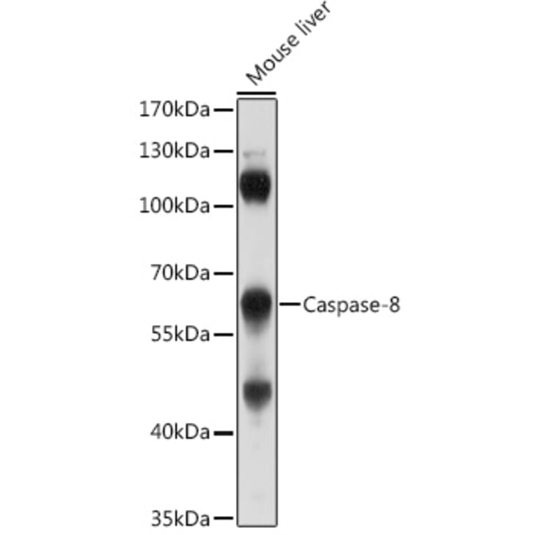 Western Blot - Anti-Caspase-8 Antibody (A80797) - Antibodies.com
