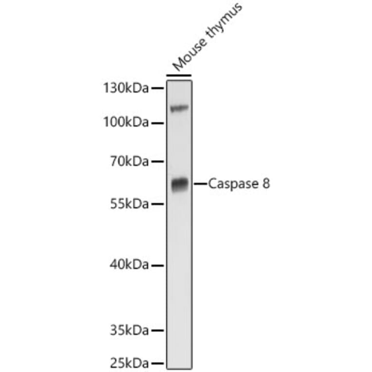 Western Blot - Anti-Caspase-8 Antibody (A80797) - Antibodies.com