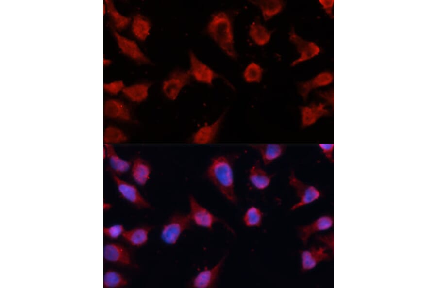 Immunofluorescence - Anti-Caspase-8 Antibody (A80797) - Antibodies.com