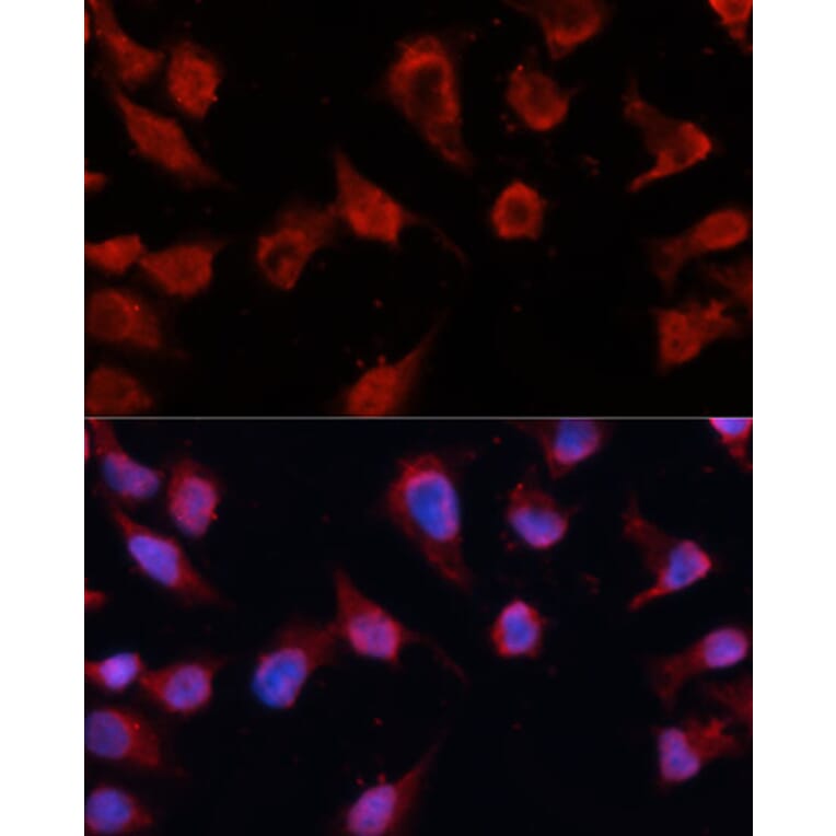 Immunofluorescence - Anti-Caspase-8 Antibody (A80797) - Antibodies.com