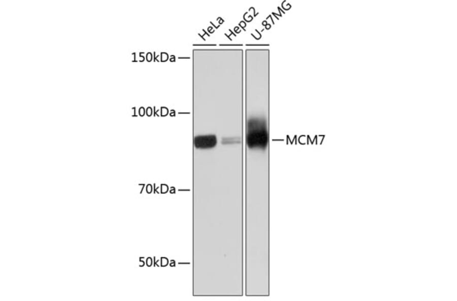 Western Blot - Anti-MCM7/PRL Antibody [ARC0573] (A80798) - Antibodies.com