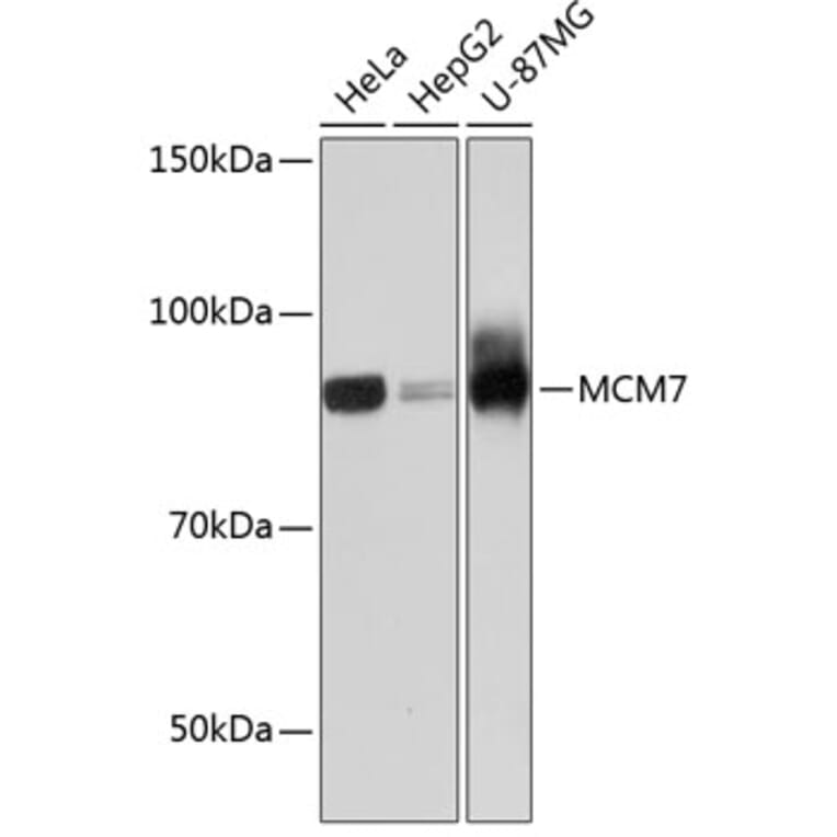Western Blot - Anti-MCM7/PRL Antibody [ARC0573] (A80798) - Antibodies.com