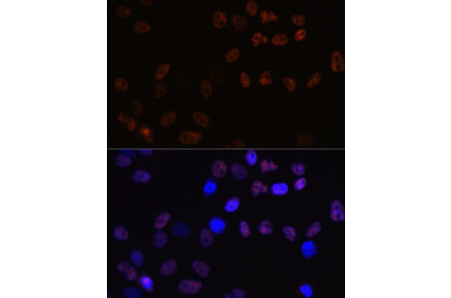 Immunofluorescence - Anti-MCM7/PRL Antibody [ARC0573] (A80798) - Antibodies.com
