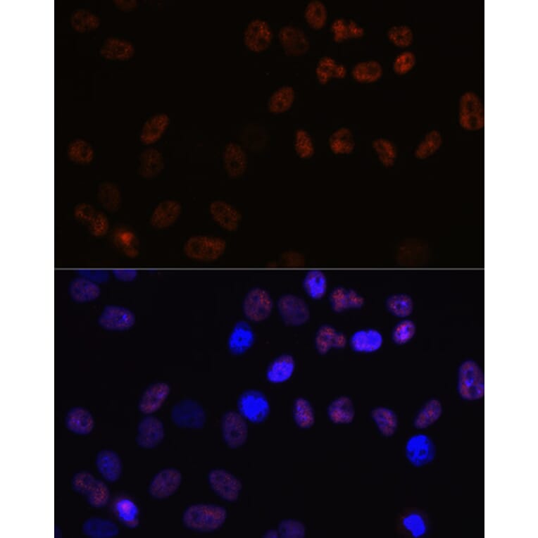 Immunofluorescence - Anti-MCM7/PRL Antibody [ARC0573] (A80798) - Antibodies.com