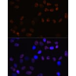 Immunofluorescence - Anti-MCM7/PRL Antibody [ARC0573] (A80798) - Antibodies.com