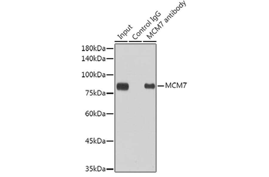 Western Blot - Anti-MCM7/PRL Antibody [ARC0573] (A80798) - Antibodies.com